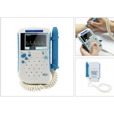 Ultraääni Doppler Blood Flow Detector Series BV{0}}T (yksisuuntainen/kaksisuuntainen